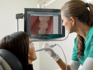 Cámara intraoral