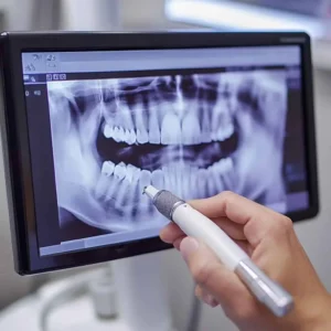 Radiografía digital dental
